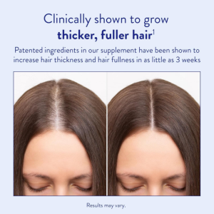 Hair Growth Capsules - Revitalize Hair Follicles and Restore Lustrous Hair